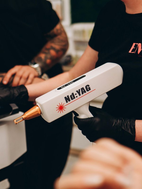 Détatouage au havre : retrouver une peau sans tatouage